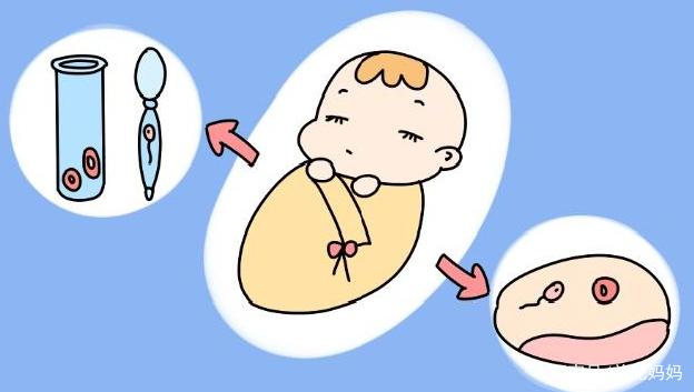 孕妇