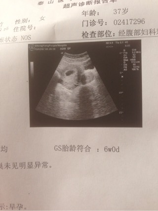 月经排出像果冻一样的血块