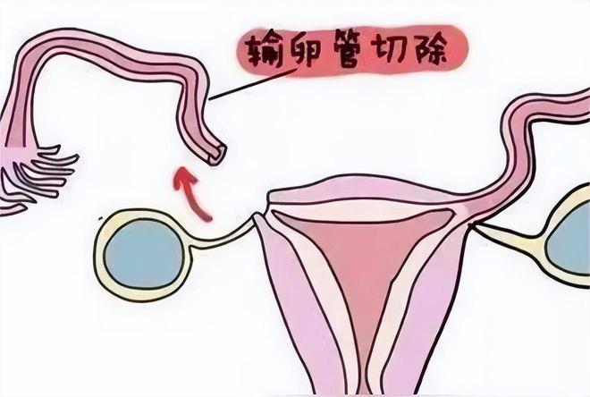 月嫂