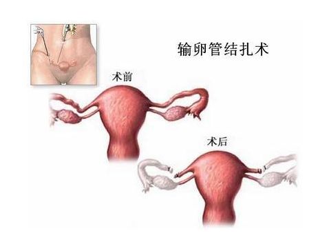 月经推迟